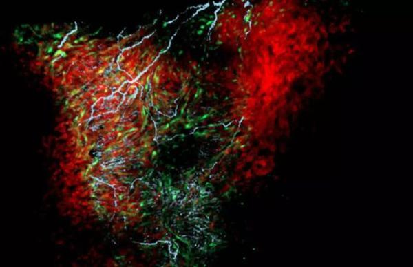 کشف یک سلول نو در قلب